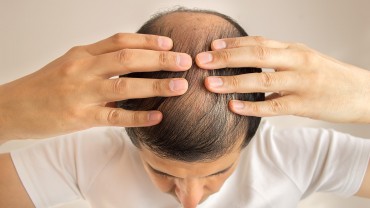 Human Growth Hormone For Hair Loss And Regrowth