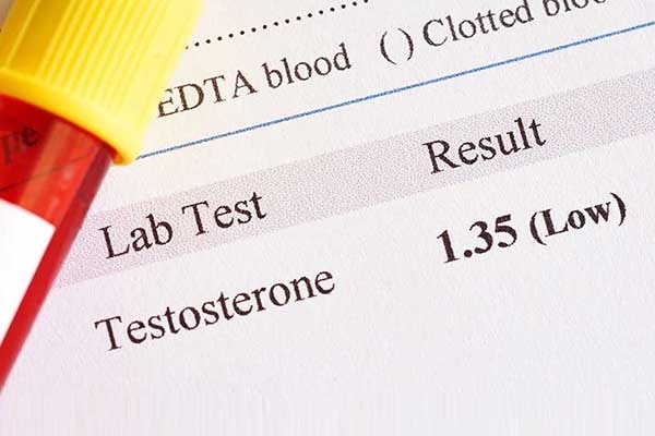 Natural and Artificial Ways To Lower Testosterone