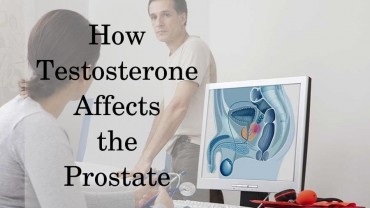 Can Testosterone Therapy Cause Prostate Enlargement or Cancer?