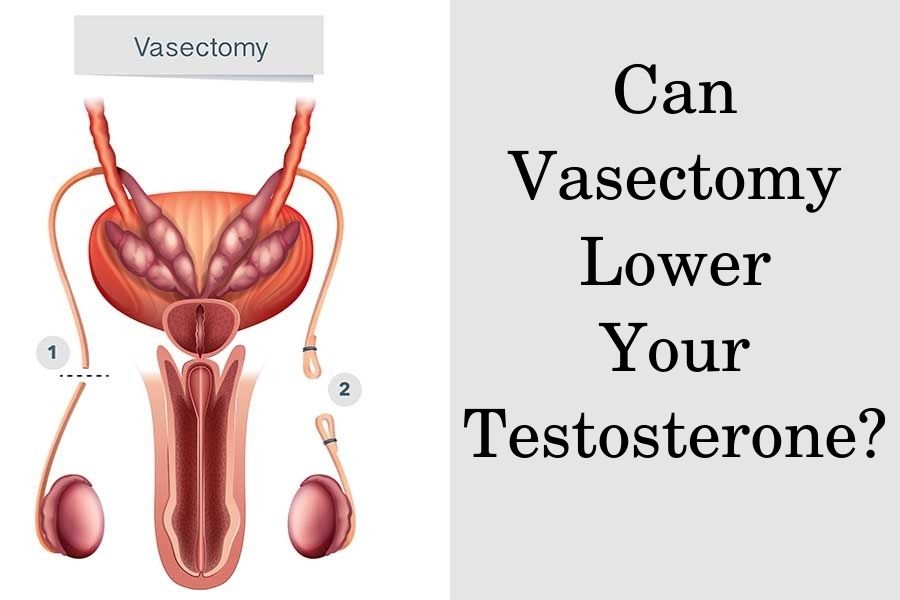 How Does a Vasectomy Affect Testosterone?