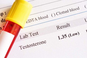 Low T blood tests results