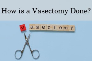How is a vasectomy done?