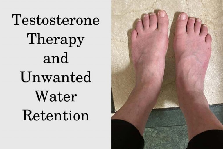 Water Retention from TRT | Does Every Patient Suffer? | HRTGuru Clinic