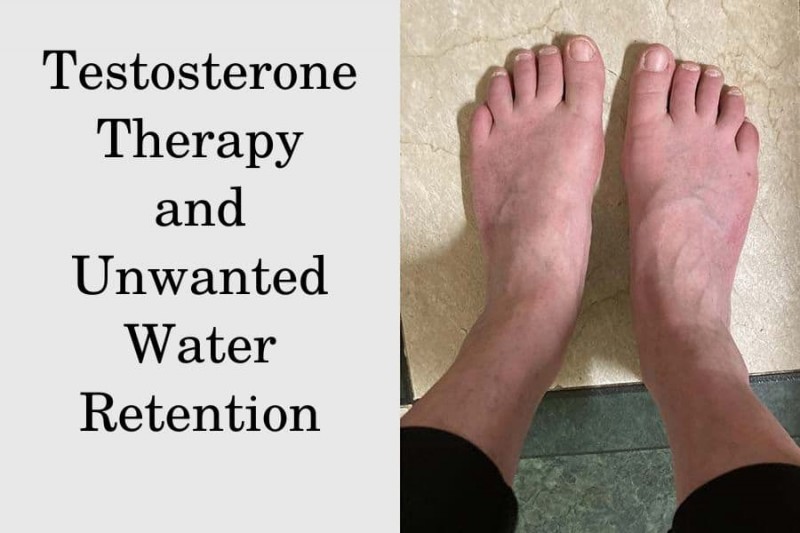 How To Get Rid Of Water Retention While On Testosterone Water Retention from TRT | Does Every Patient Suffer? | HRTGuru Clinic
