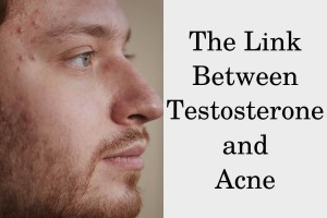 What's the link between testosterone and acne?
