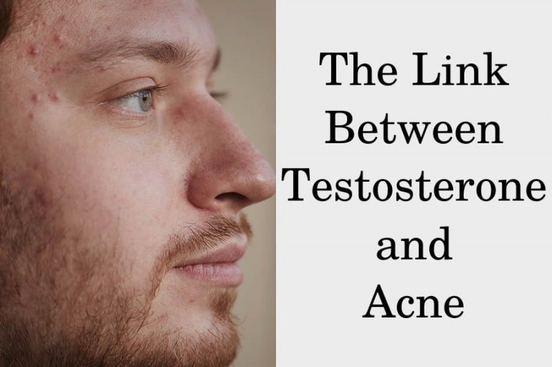 Is Testosterone A Cause Of Your Acne HRTGuru