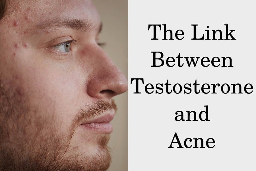 is-testosterone-a-cause-of-your-acne-hrtguru