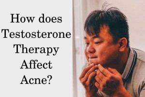 How does testosterone affect acne?